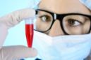 Your Blood Type Could Predict Your Chances of Catching COVID