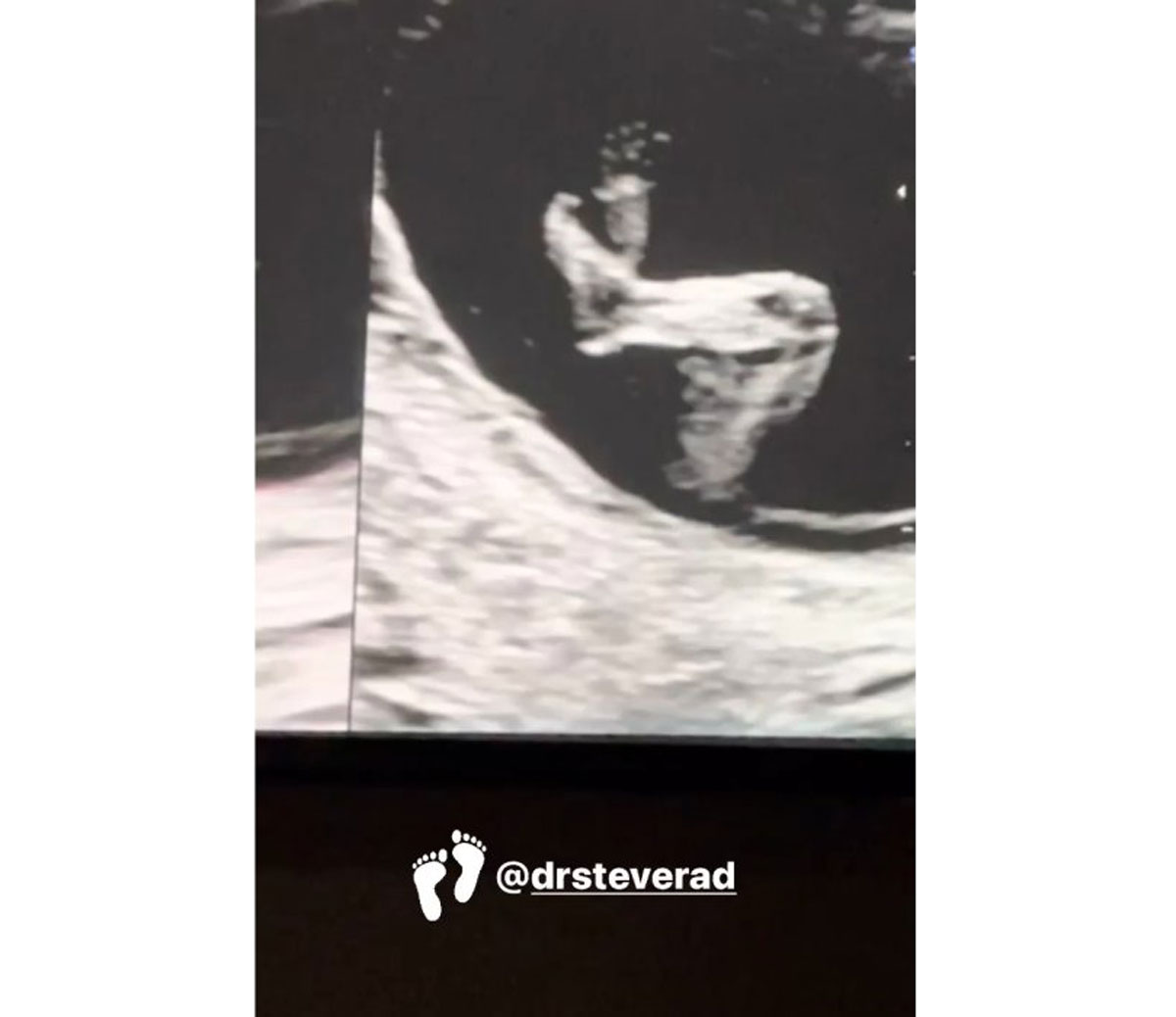 Halsey showed off her new sonogram in an Instagram Stories shot on Friday night!