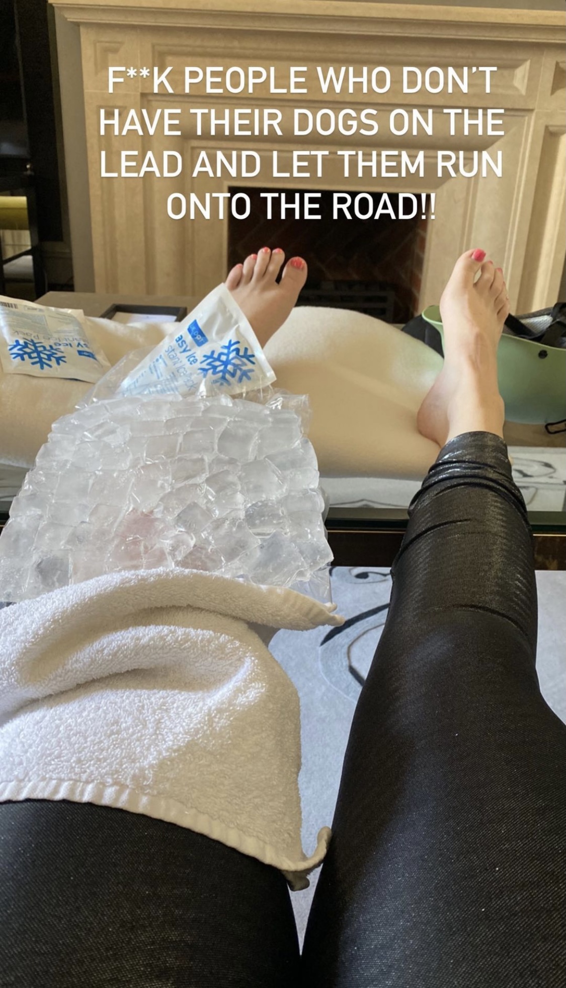 Rebel Wilson Recovers After Biking Accident With An Unleashed Dog!