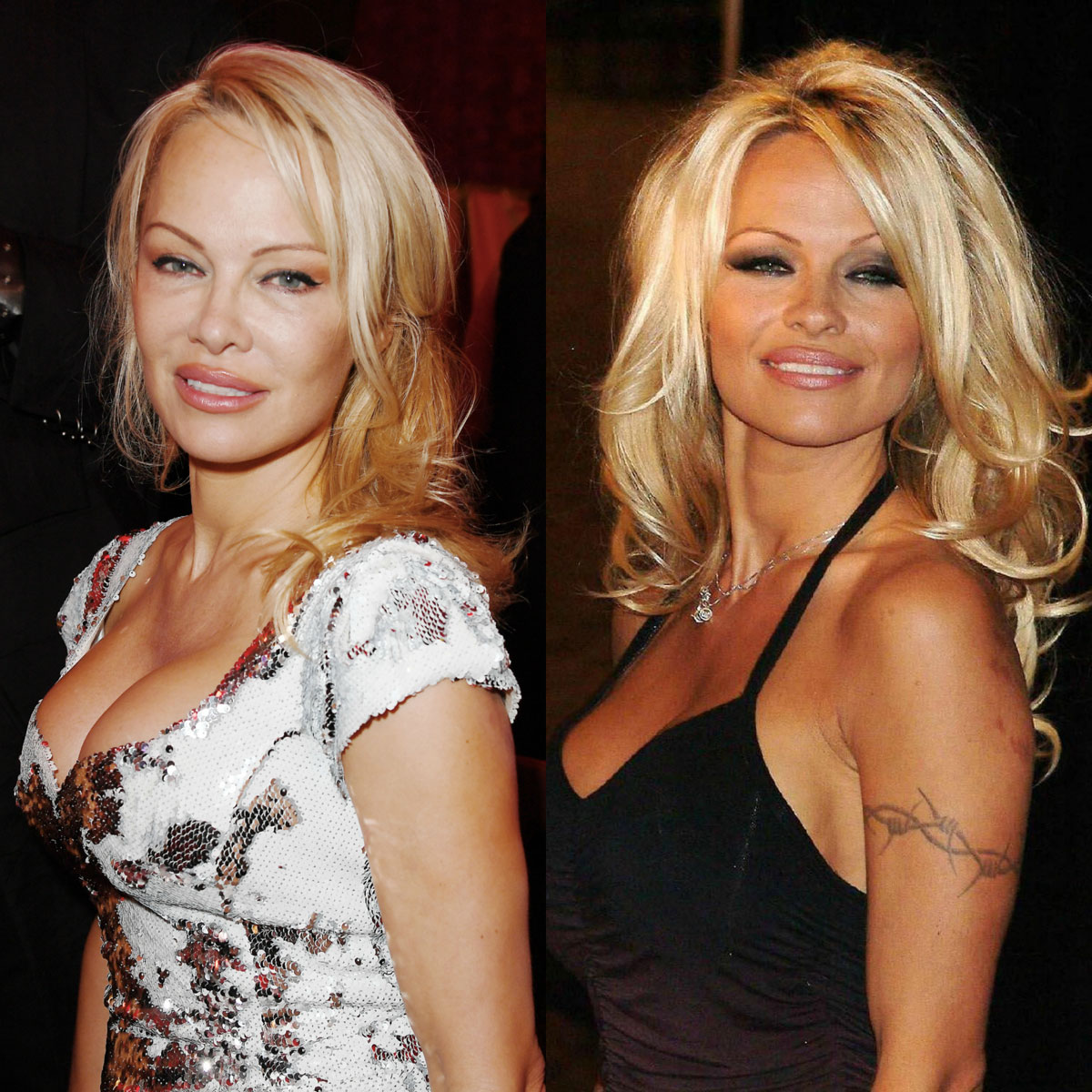 Pamela Anderson removed her arm tattoo