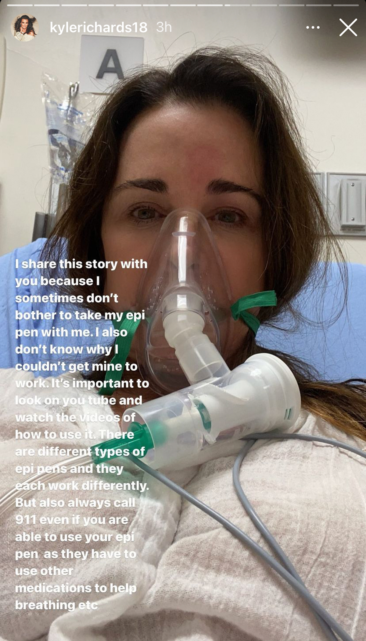 SO SCARY! RHOBH Star Kyle Richards Hospitalized After Walking Into The latest Beehive! 