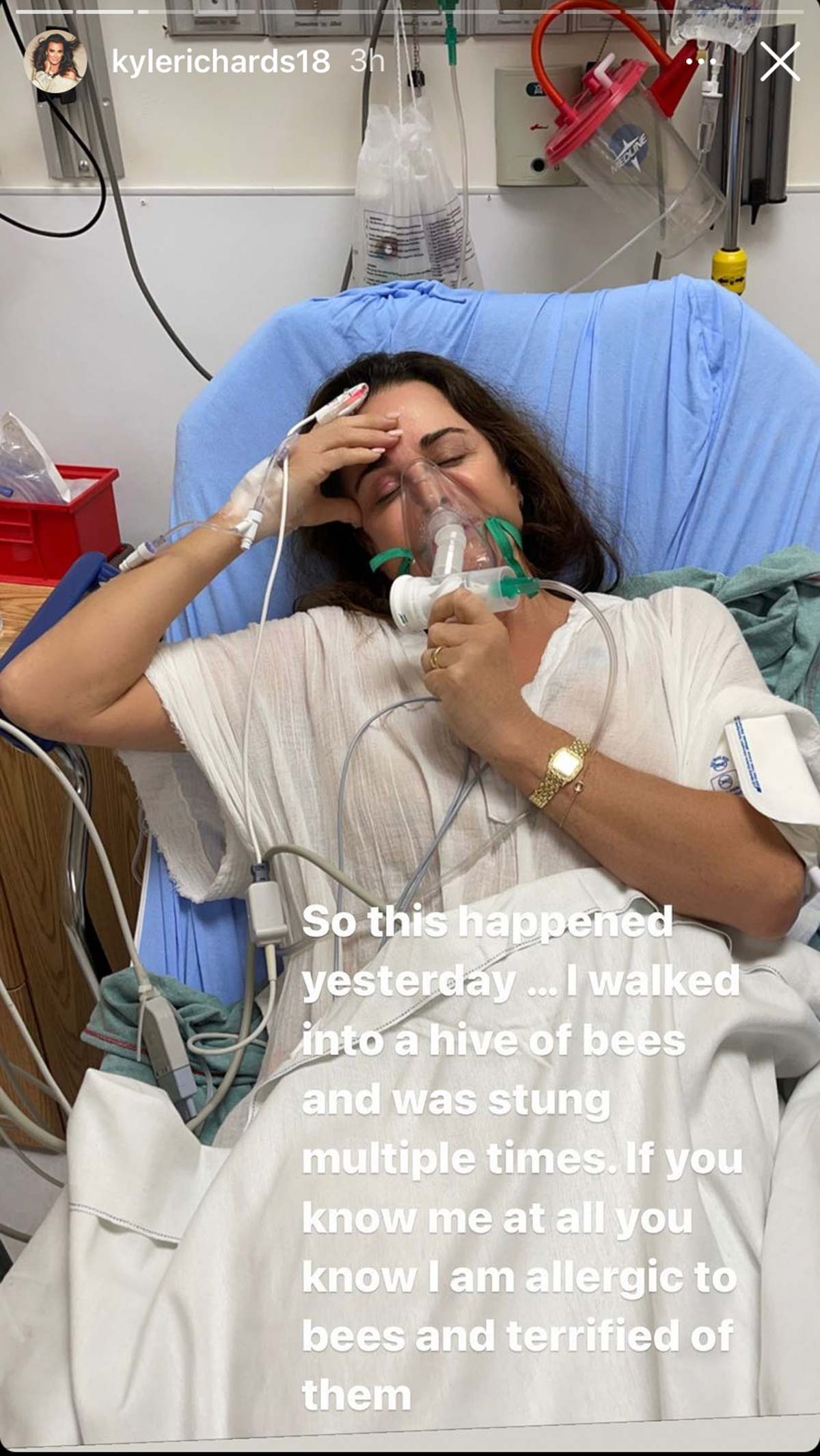 SO SCARY! RHOBH Super star Kyle Richards Hospitalized After For walks Into A Beehive! 
