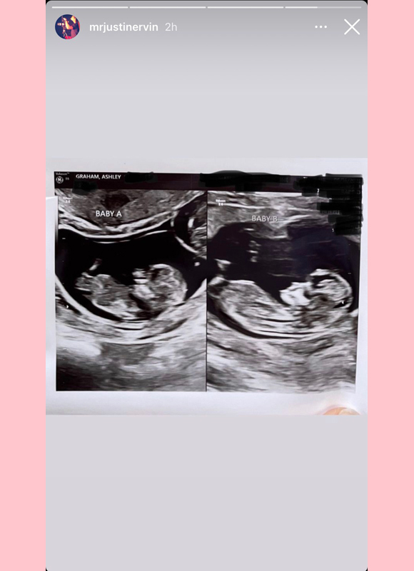 justin ervin, ashley graham : justin shares ultrasound of twins on IG story